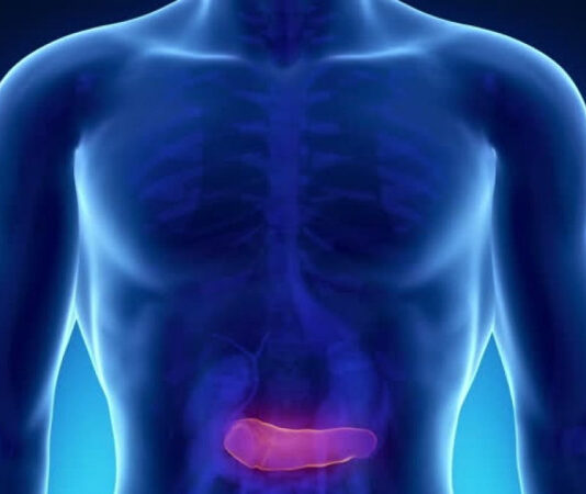 Pancreatic Pseudocyst Treatment